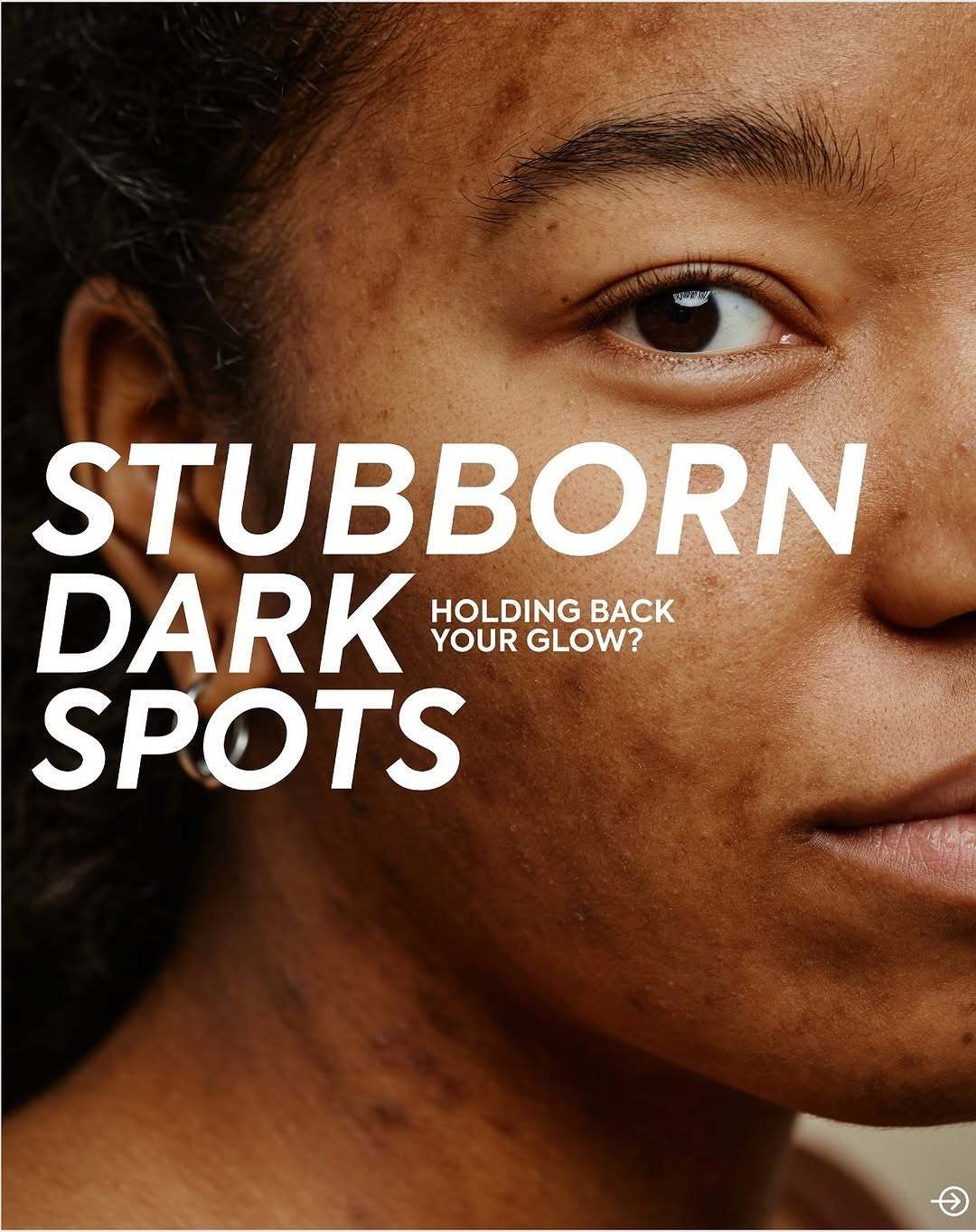 Brighten your skin with the Makari Exclusive Dark Spot Corrector Serum.
Targeted treatment for dark spots and uneven skin tone, revealing a smoother, more radiant you with every drop.
